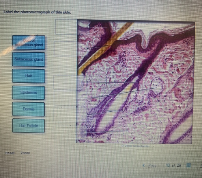 Label the photomicrograph of thin skin.