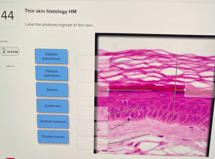 Epidermal label layers micrograph stratum corneum granulosum basale biology str answers questions spinosum