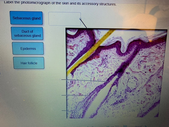 Photomicrographs sections