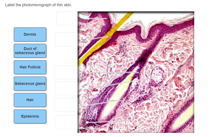 Label the photomicrograph of thin skin.