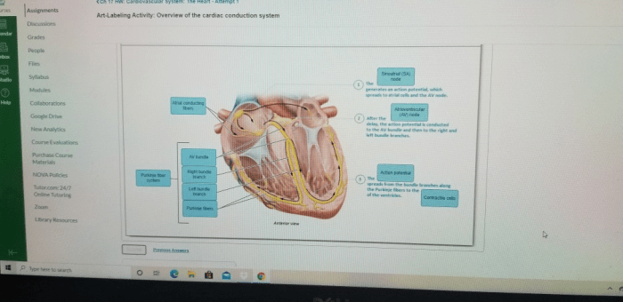 Art labeling activity overview of cranial nerves